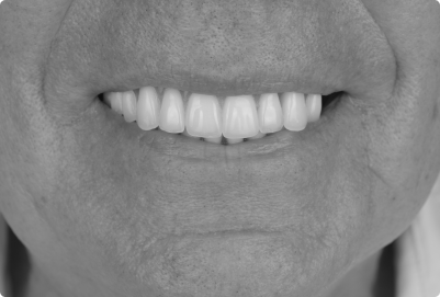 Closeup photo of a patient's teeth