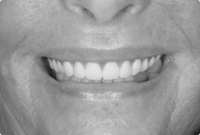 Closeup photo of a patient's teeth