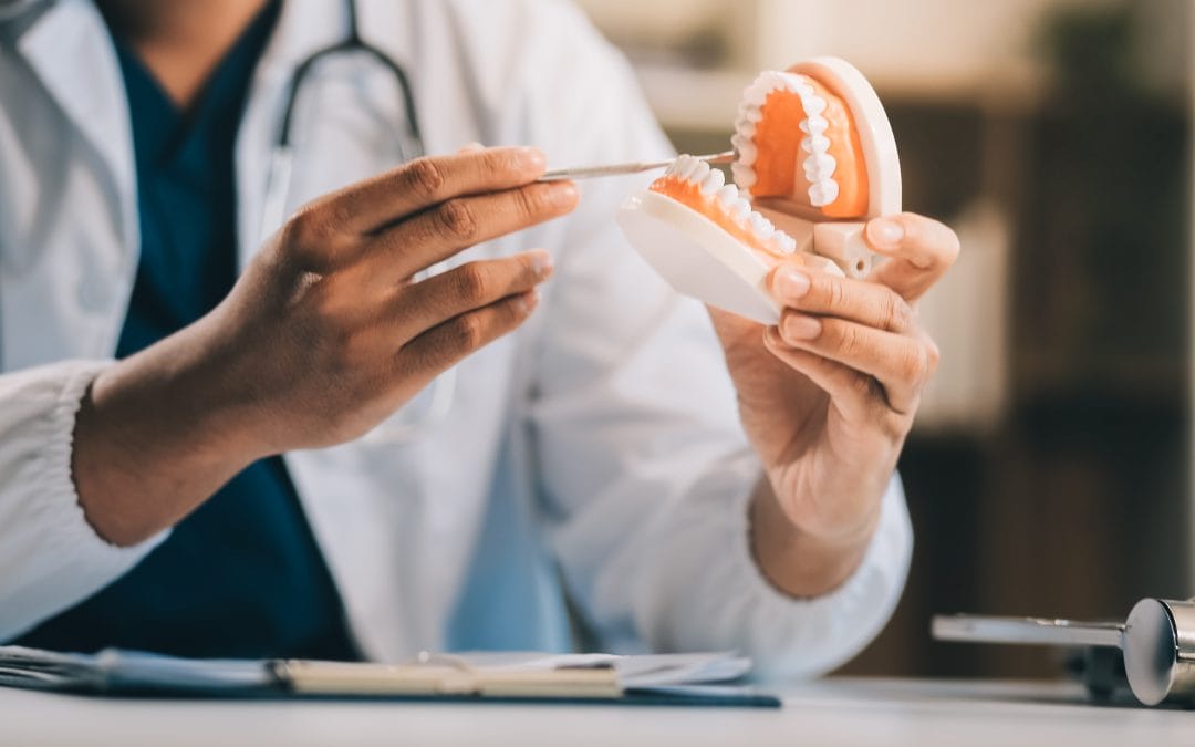 5 Things to Know Before Getting Dentures