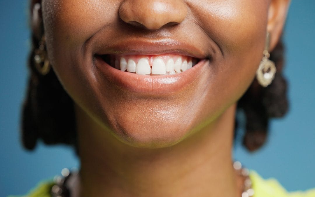 Full Mouth Reconstruction: Your Step-By-Step Guide